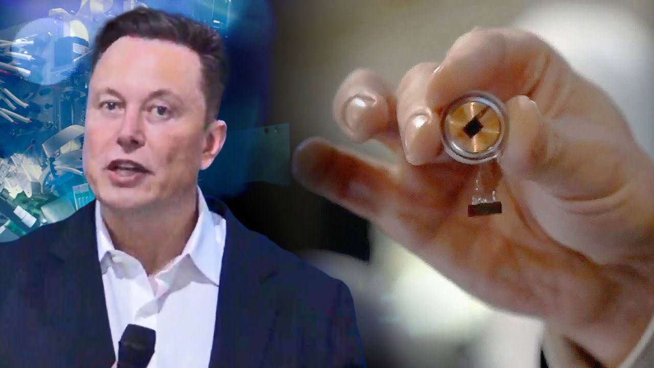 A gondolataival tudja irányítani egy számítógép egerét az első páciens, akinek egy chipet ültettek az agyába – állítja Elon Musk