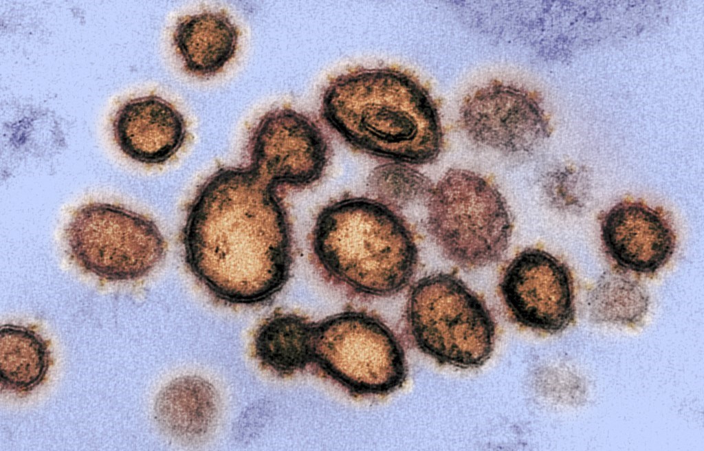 A vírusellenes szerek használata gyorsíthatja a Covid evolúcióját a tudósok szerint