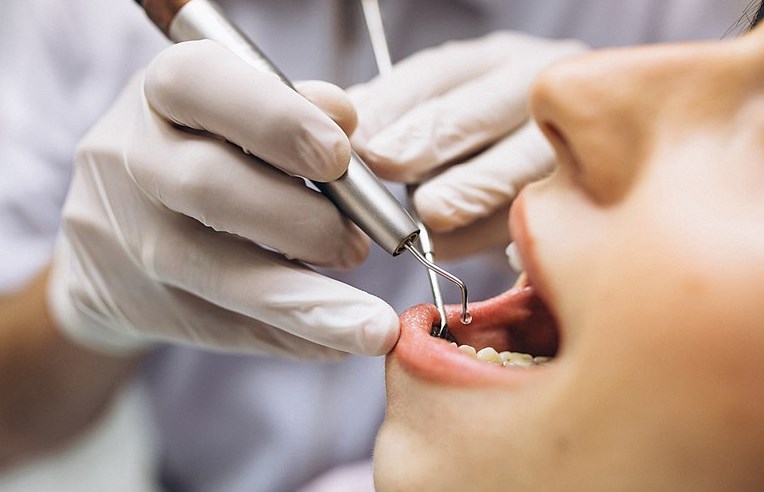 Álfogorvosok vertek át egy debreceni nőt, hét fogát húzták ki feleslegesen