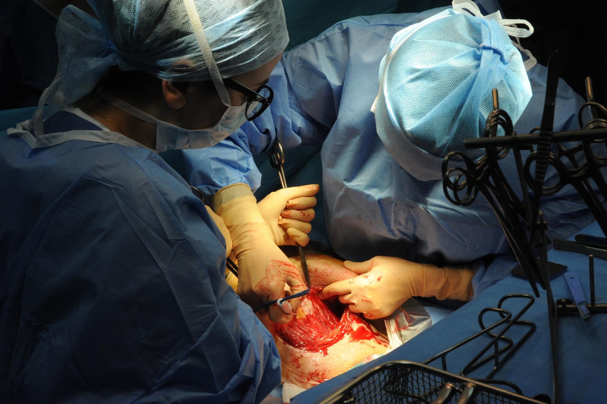 Life + Style: Doctors left a plate-sized device in a woman’s body after a caesarean section in New Zealand