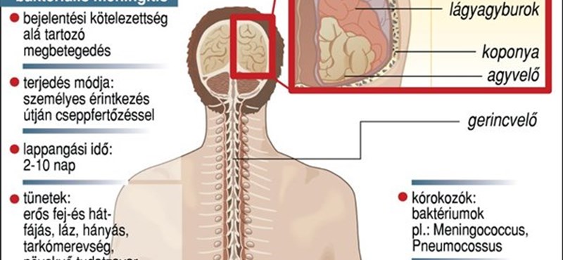 Fertőző agyhártyagyulladással vittek kórházba egy corvinusos hallgatót