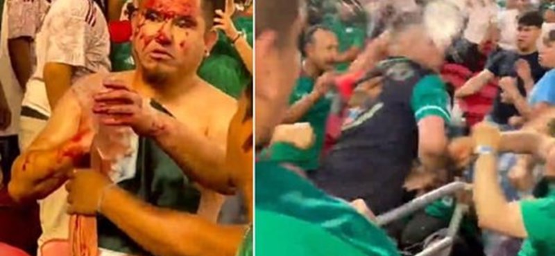 Another Mexican fan was stabbed in the chest during the Gold Cup final