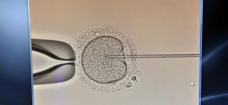 Se crea el primer embrión humano artificial, sin óvulo ni espermatozoide