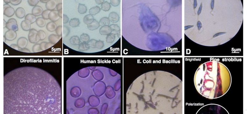 Így építhettek egy dollárból mikroszkópot